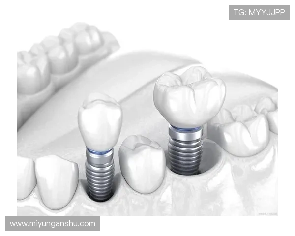 问鼎苹果官网下载安装流程详细解析确保每一步都顺利完成